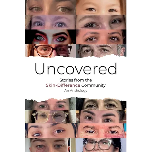 Uncovered: Stories from the Skin-Difference Community